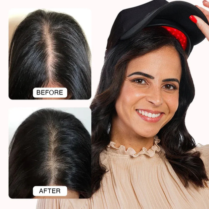 Regrow your hair in 120 days with Newlumin Laser Cap or your money back!
